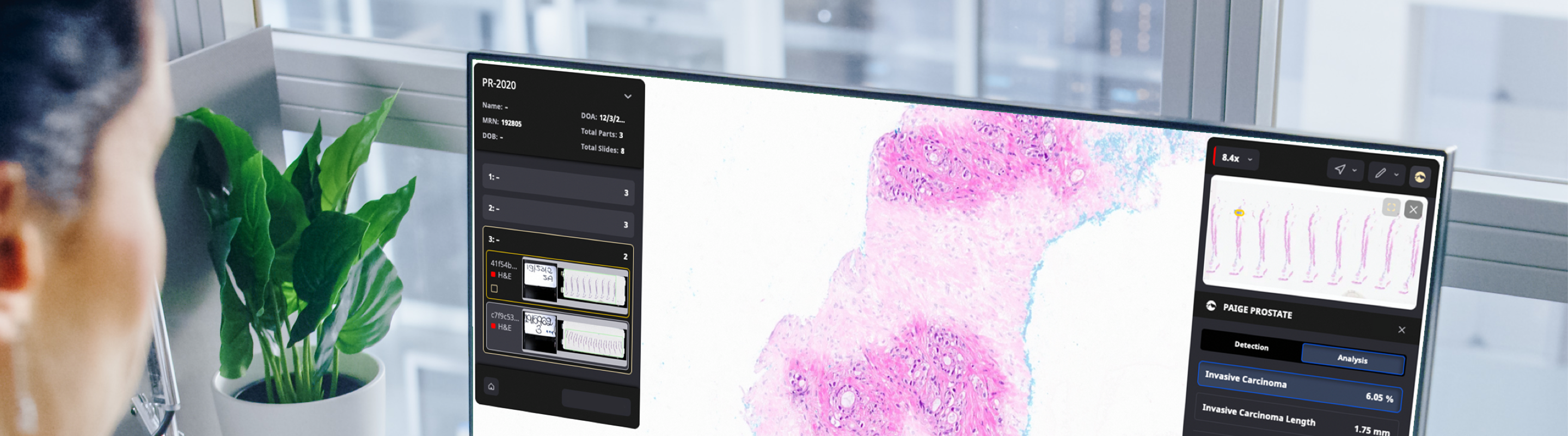 Digital pathology workflow-background-img